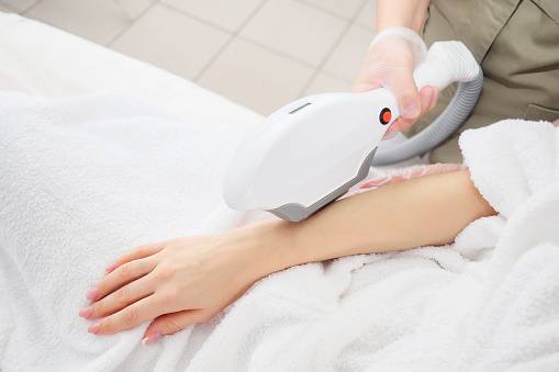 Où faire une séance d’épilation laser des bras pour une femme proche de Fécamp 76 ?